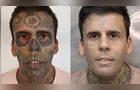 'Mais tatuado do Brasil' passa por nova remoção e fala em vida missionária