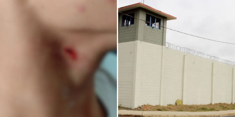 O adolescente foi encaminhado ao CENSE