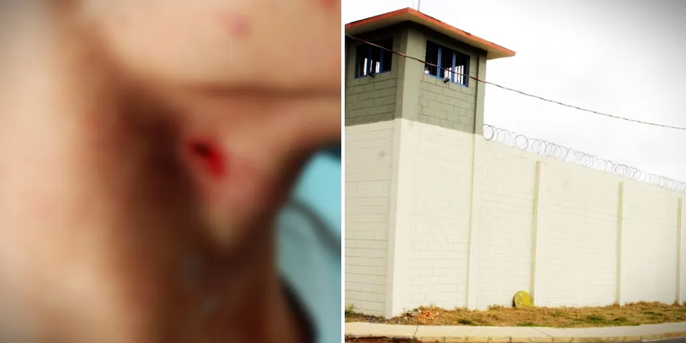 Estudante foi golpeado na região do pescoço