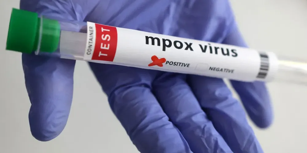 Número de confirmações mais que dobrou desde a segunda quinzena de fevereiro