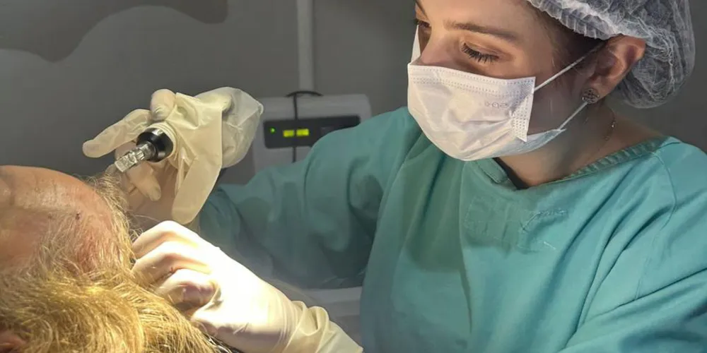 Diagnóstico precoce para alopécia é fundamental para evitar danos irreversíveis