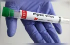 Casos de mpox dobram no Brasil e chegam a 129; SP tem 66% das confirmações