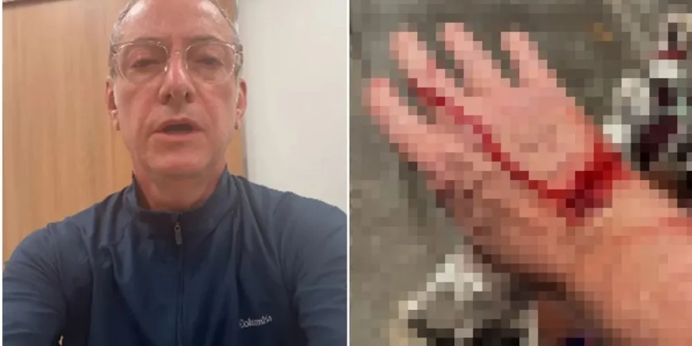O animal avançou contra ele e seus cachorros