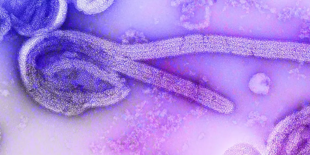 Imagem microscópica eletrônica do vírus Ebola