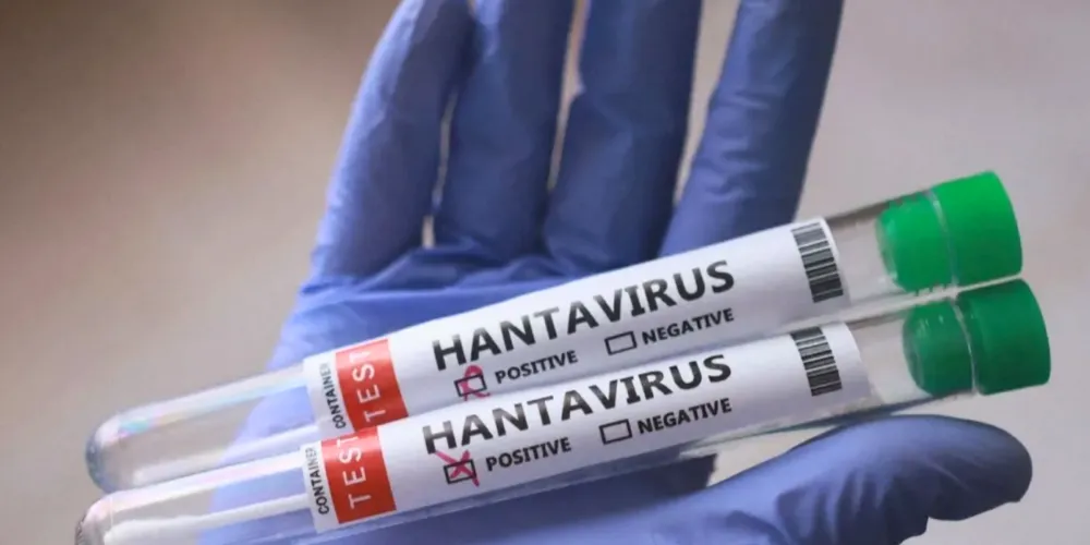 Tubos de ensaio com amostras do hantavírus
