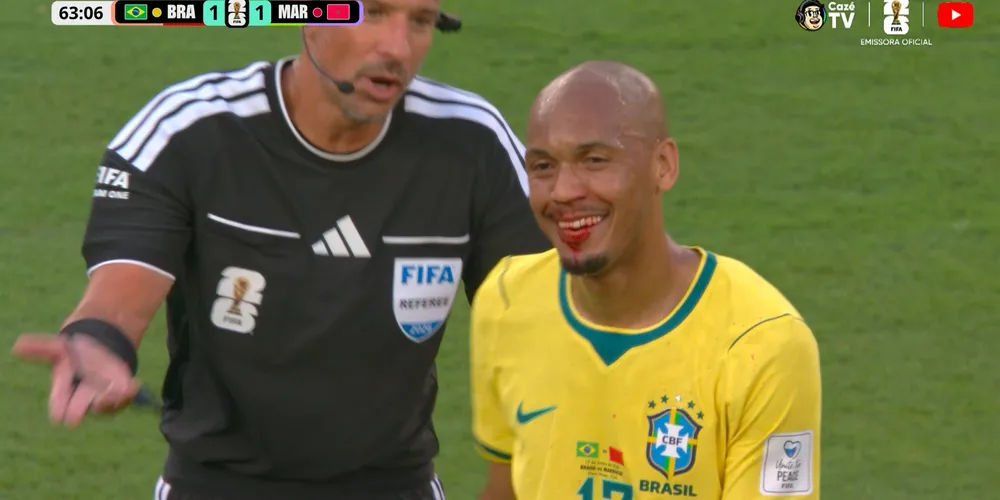 Ele precisou sair de campo para ser atendido pela equipe médica da Seleção Brasileira.