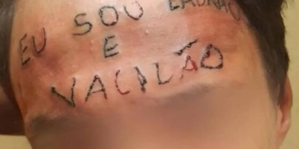 Tatuagem feita em Ruan Rocha da Silva, em 2017, após suposta tentativa de furto de bicicleta
