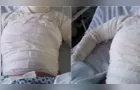 Marido é preso após colocar fogo na esposa no Paraná