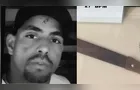 Homem morre após ser agredido na cabeça em General Carneiro