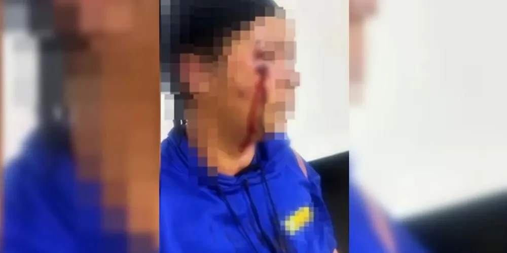 Mulher chicoteada no rosto por suspeita de relação com homem casado