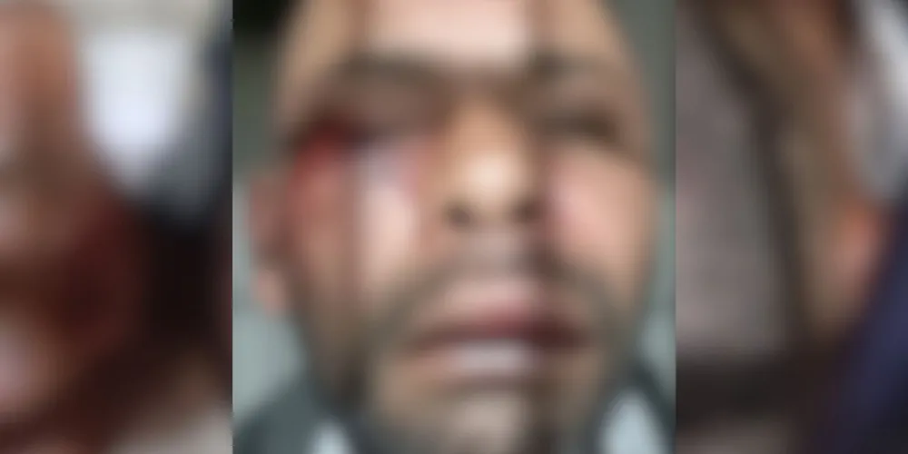 O homem foi atendido pelo SAMU e foi preso pela GCM