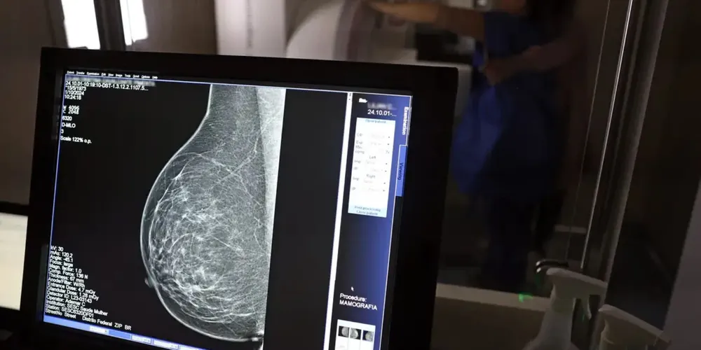 Os planos de saúde serão obrigados a cobrir exame de mamografia digital para todas as pessoas sempre que houver indicação médica