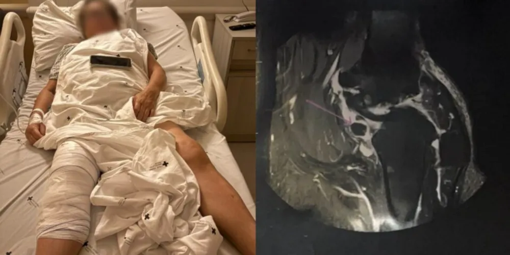 Marilda ficou com os dois joelhos comprometidos, diz família