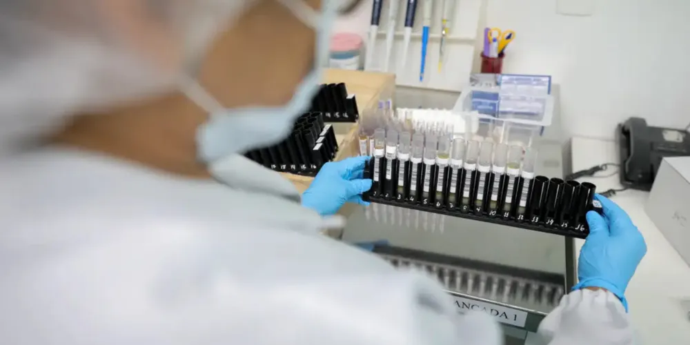 Imunizante será testado em 48 voluntários sem infecção prévia