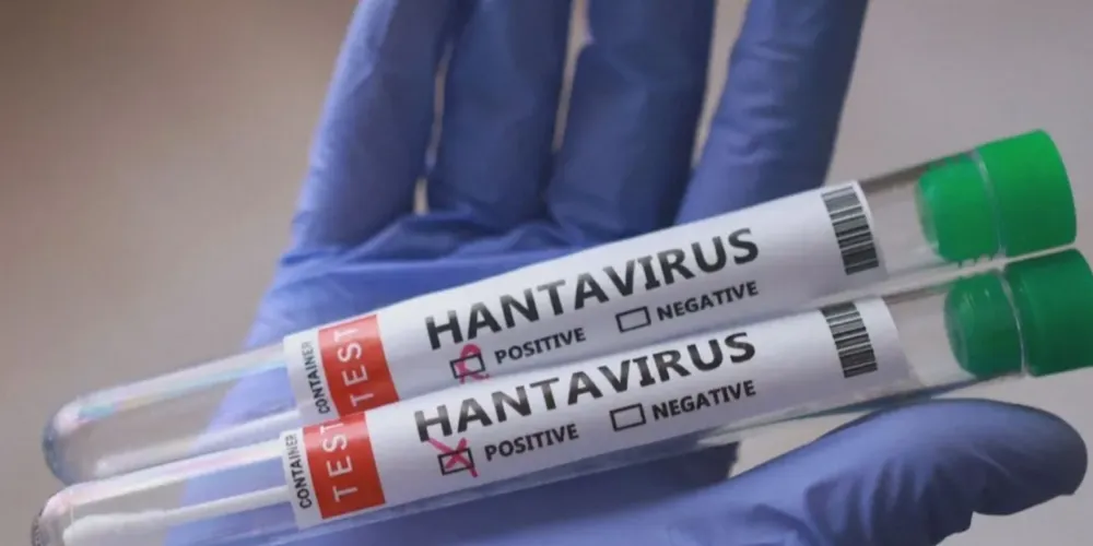 Dados contemplam informações sobre relacionadas à dengue, leptospirose, hantavirose, entre outros