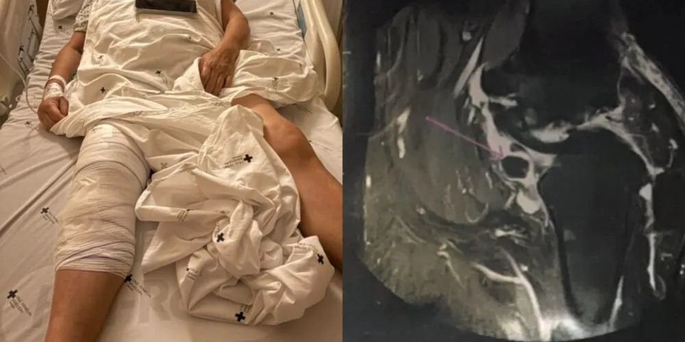 Após caso de cirurgia no joelho errado, hospital de Curitiba anuncia apuração interna