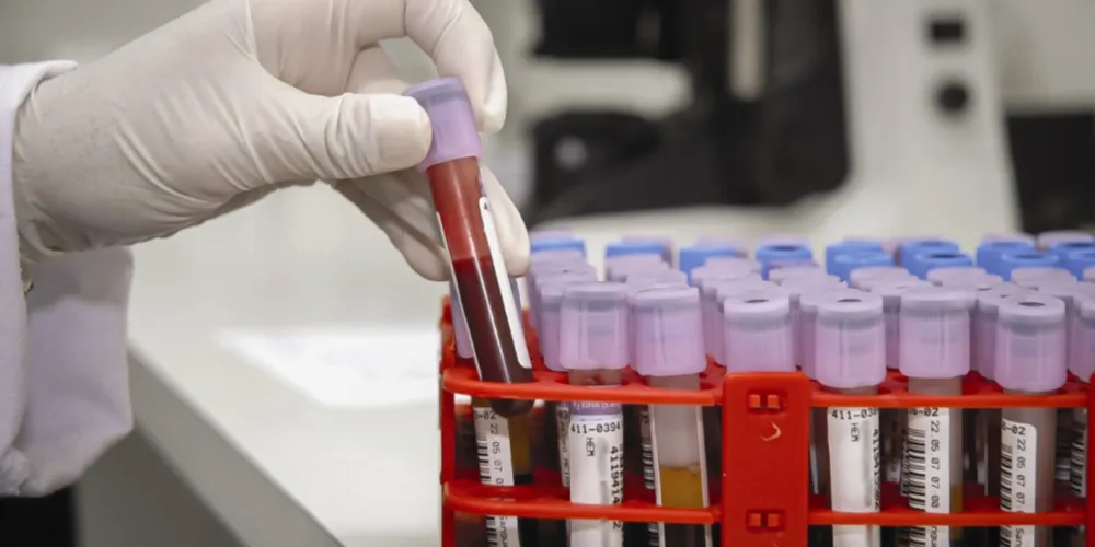 A redução nas faltas contribui para um melhor aproveitamento dos horários