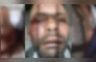 Homem invade casa de ex, agride mulher e acaba espancado em PG