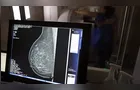 Plano de saúde terá que cobrir mamografia digital para todas as idades