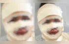 Mulher joga água fervente na atual namorada do ex e acaba presa