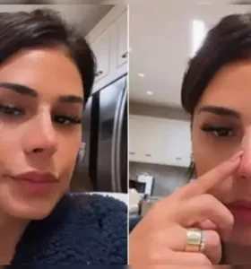 Simone Mendes foi alvo de críticas nas redes sociais pelo resultado de procedimentos no nariz