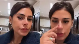 Alvo de comentários negativos, novo nariz de Simone Mendes ganha defesa de Gretchen
