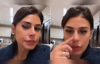 Simone Mendes foi alvo de críticas nas redes sociais pelo resultado de procedimentos no nariz