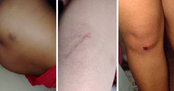Mulher fica ferida após ser agredida por PM no Metrô