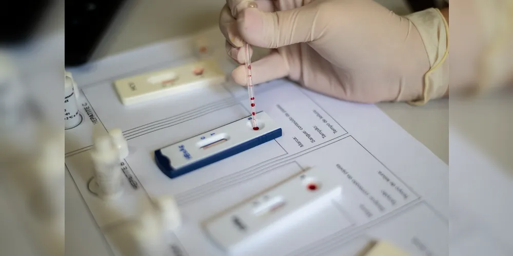 Ponta Grossa possui indicador máximo na oferta do tratamento com a Profilaxia Pré-Exposição (PrEP), segundo dados do Ministério da Saúde