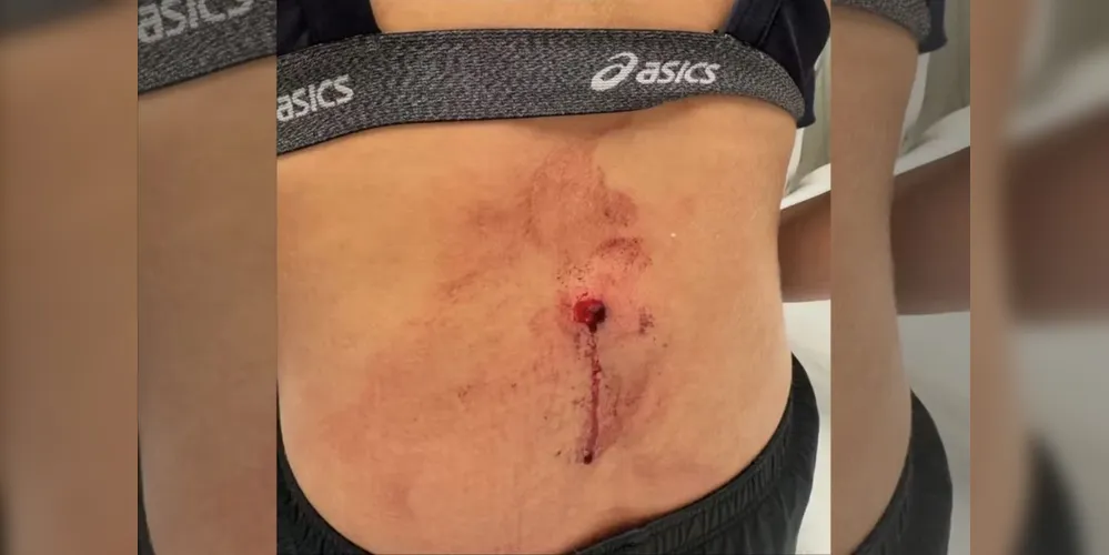 Imagem ilustrativa da imagem Jogadora de vôlei é baleada em tentativa de assalto no Rio de Janeiro; veja