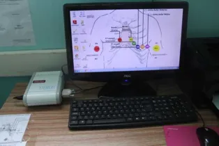 Imagem ilustrativa da imagem Irati passa a oferecer exames de eletrocardiograma