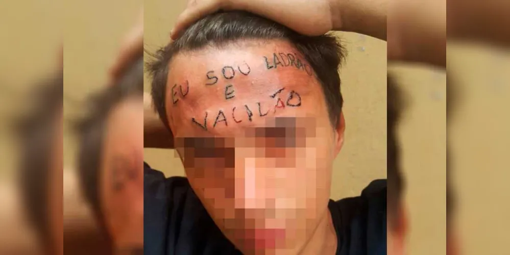 Imagem ilustrativa da imagem STJ nega habeas corpus a homem que tatuou testa de adolescente
