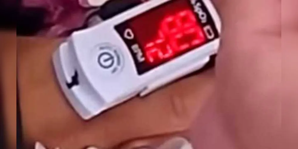 Médico usou aparelho para medir batimentos cardíacos no morto/Foto: Reprodução YouTube