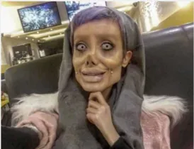 Imagem ilustrativa da imagem Iraniana faz 50 cirurgias para ficar igual a Angelina Jolie