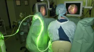 Alguns casos de hiperplasia de próstata exigem intervenção cirúrgica como a ressecção endoscópica/Foto: Reprodução Science Photo Library