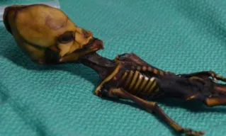 Esqueleto de menina encontrado no Chile/Foto: Reprodução COLD SPRING HARBOR LABORATORY