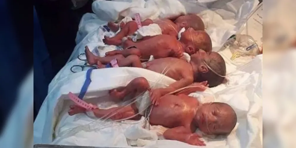 O nascimento dos seis meninos e uma menina é o primeiro caso registrado de sétuplos no Oriente Médio