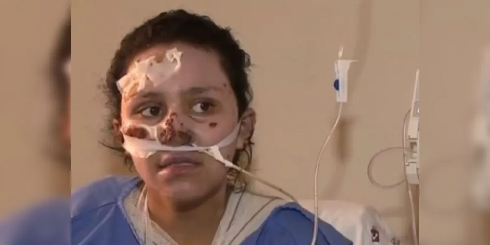 Menina que salvou irmão de incêndio morre no hospital