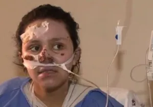 Menina que salvou irmão de incêndio morre no hospital