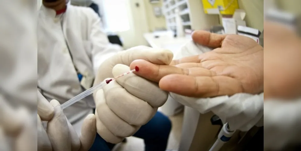 O teste de HIV é essencial para garantir que as pessoas sejam diagnosticadas precocemente e iniciem o tratamento