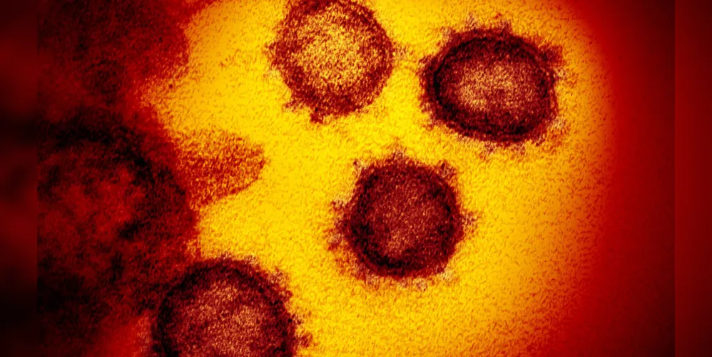 Imagem do microscópio eletrônico de transmissão mostra o SARS-CoV-2 – também conhecido como 2019-nCoV, o vírus que causa o COVID-19