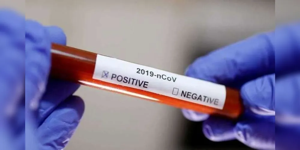 PG soma 25 casos confirmados do novo coronavírus