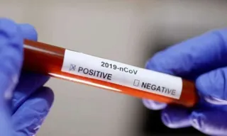 PG soma 25 casos confirmados do novo coronavírus