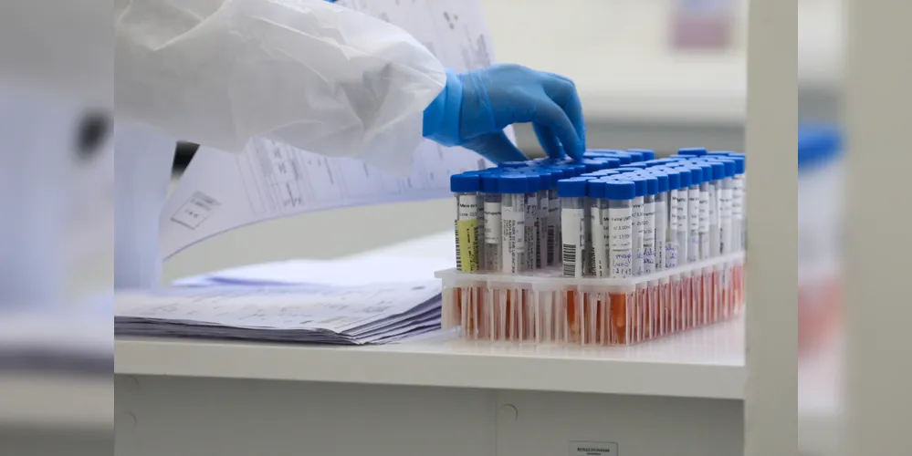 Equipe da Saúde coletou o exame RT-PCR e agora aguarda o resultado para confirmar oficialmente o registro do óbito por coronavírus. 