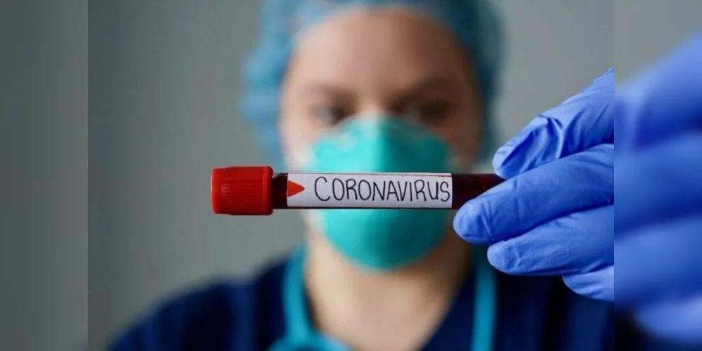 1.012 pacientes com diagnóstico confirmado de Covid-19 estão internados