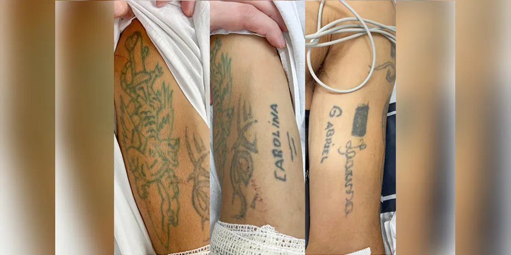 Paciente tem tatuagens nos dois braços, cerca de 40 anos de idade e não portava documentos