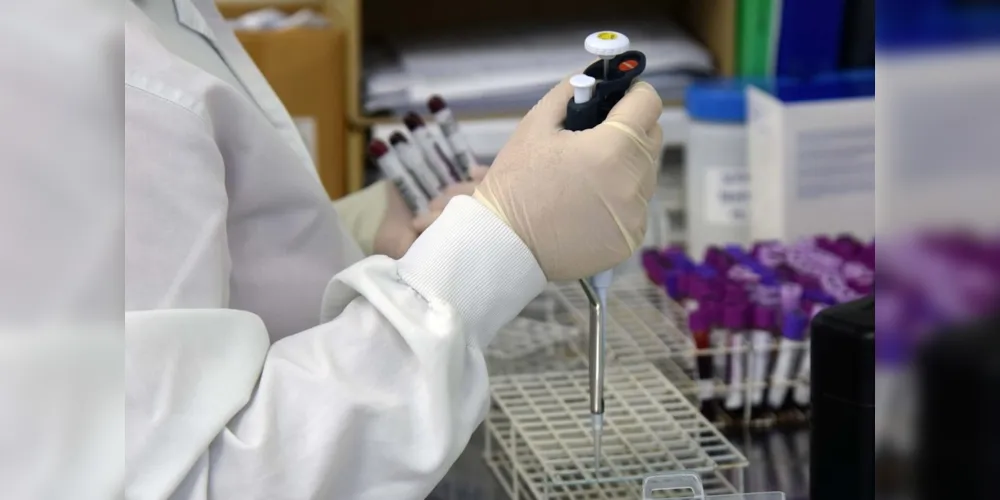 Marca de 1,029 milhão de testes RT-PCR foi alcançada nesta semana