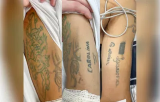 Paciente tem tatuagens nos dois braços, cerca de 40 anos de idade e não portava documentos
