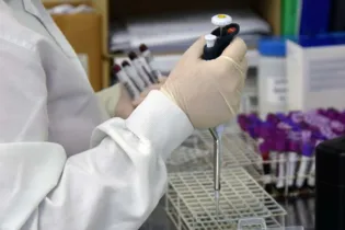 Marca de 1,029 milhão de testes RT-PCR foi alcançada nesta semana