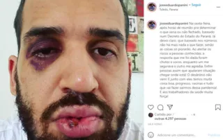 O profissional da saúde publicou a foto do rosto machucado em uma rede social 